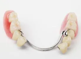 Partial Dentures
